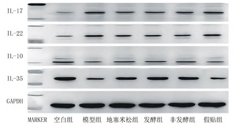 空白组和支气管哮喘各组大鼠肺组织中IL－17、IL－22、IL－10、IL－35蛋白表达电泳图